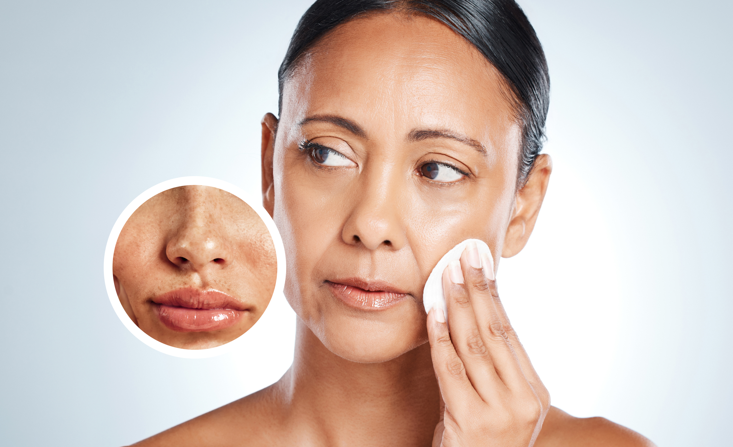 A woman with an oily skin condition gently dabs a cotton pad on her face. An inset magnifies a section of her skin, highlighting excess oil and pH imbalance issues.